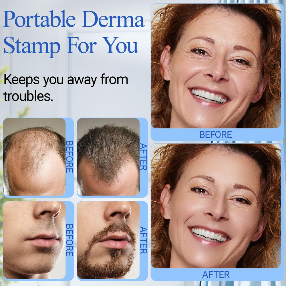 ANSIOVON Derma Stamp format compact et pratique pour voyage.