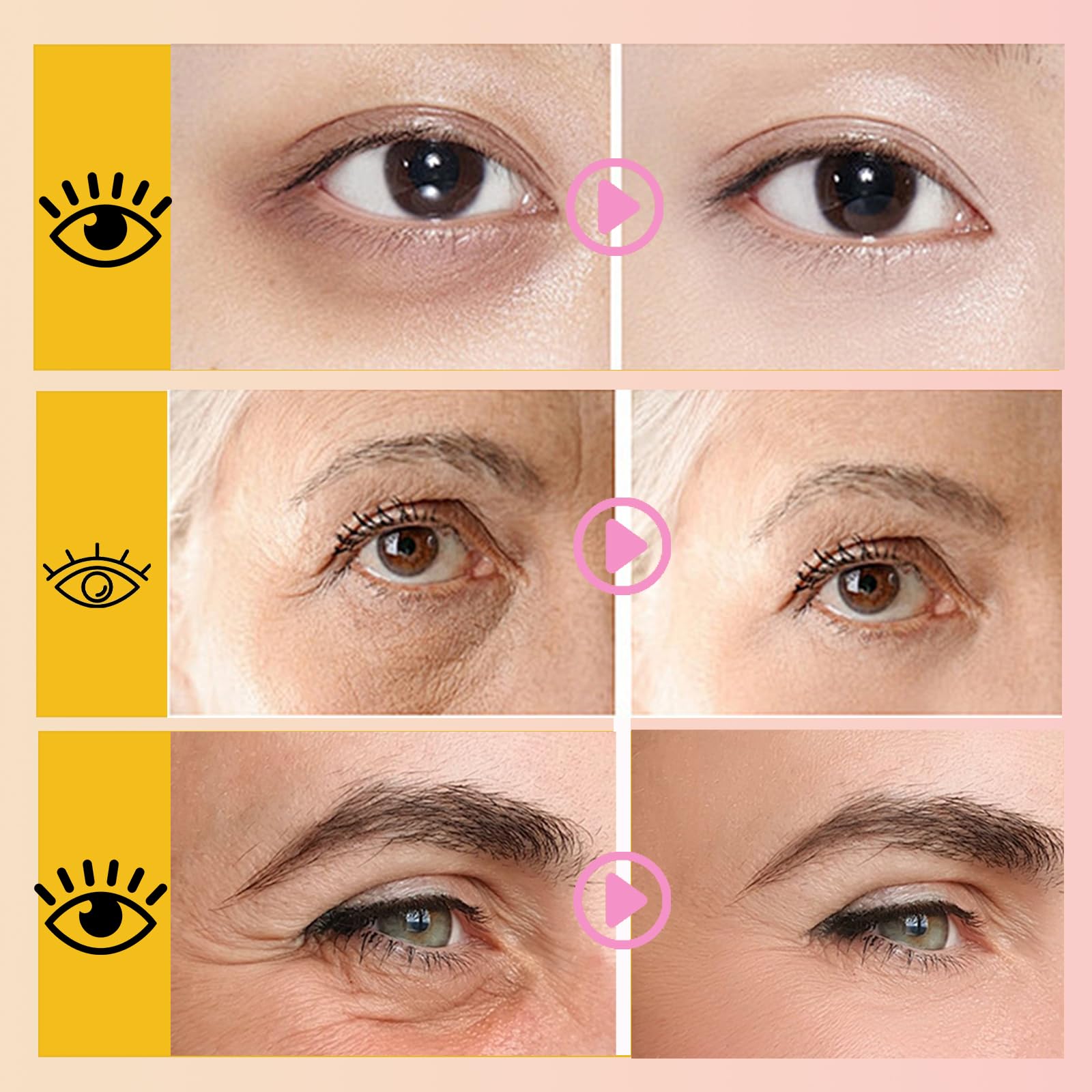 Anweina masque lèvres rose collagène, amélioration de l'élasticité des lèvres.