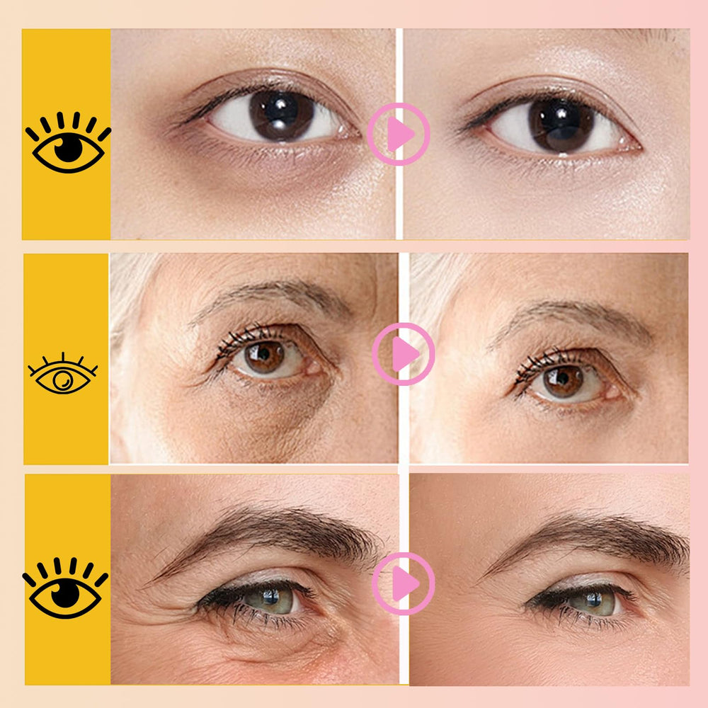 Anweina masque lèvres rose collagène, amélioration de l'élasticité des lèvres.