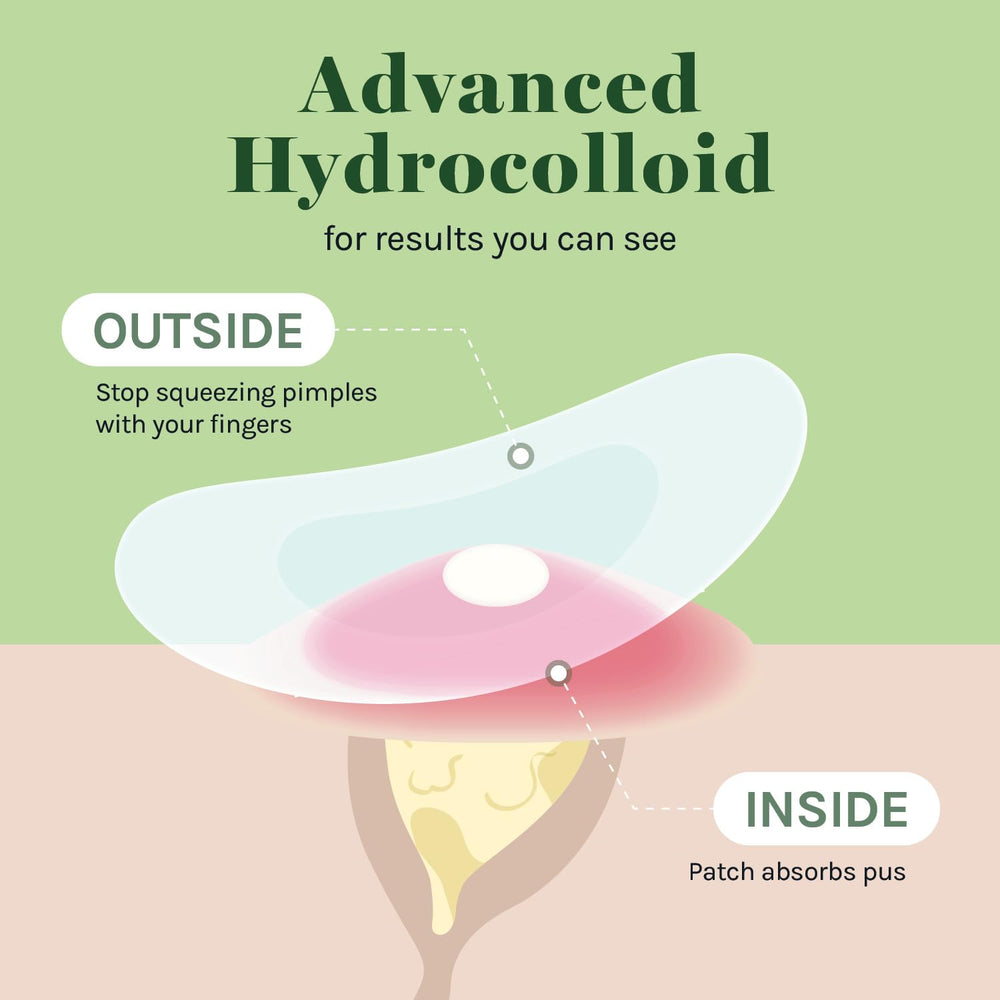Adhérence durable du pansement hydrocolloïde AOA Studio 10 mm.