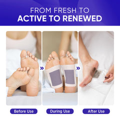 AOSORW Pads pieds aromathérapie lavande-gingembre pour un rituel apaisant.
