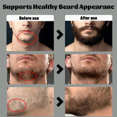 Barbe nourrie et peau-sous-jacente apaisée grâce aux ingrédients naturels