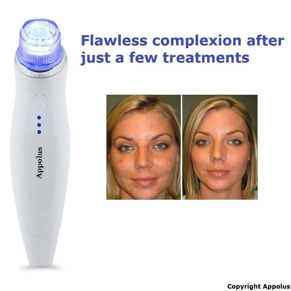 Appolus microdermabrasion design compact, utilisation rapide et rangement discret.