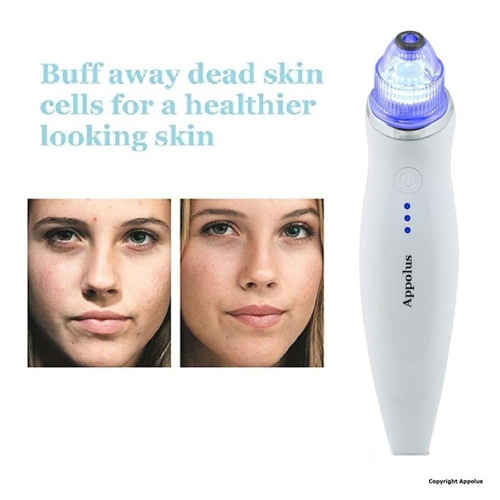 Appolus microdermabrasion embouts aspiration 3, nettoie les pores et impuretés.