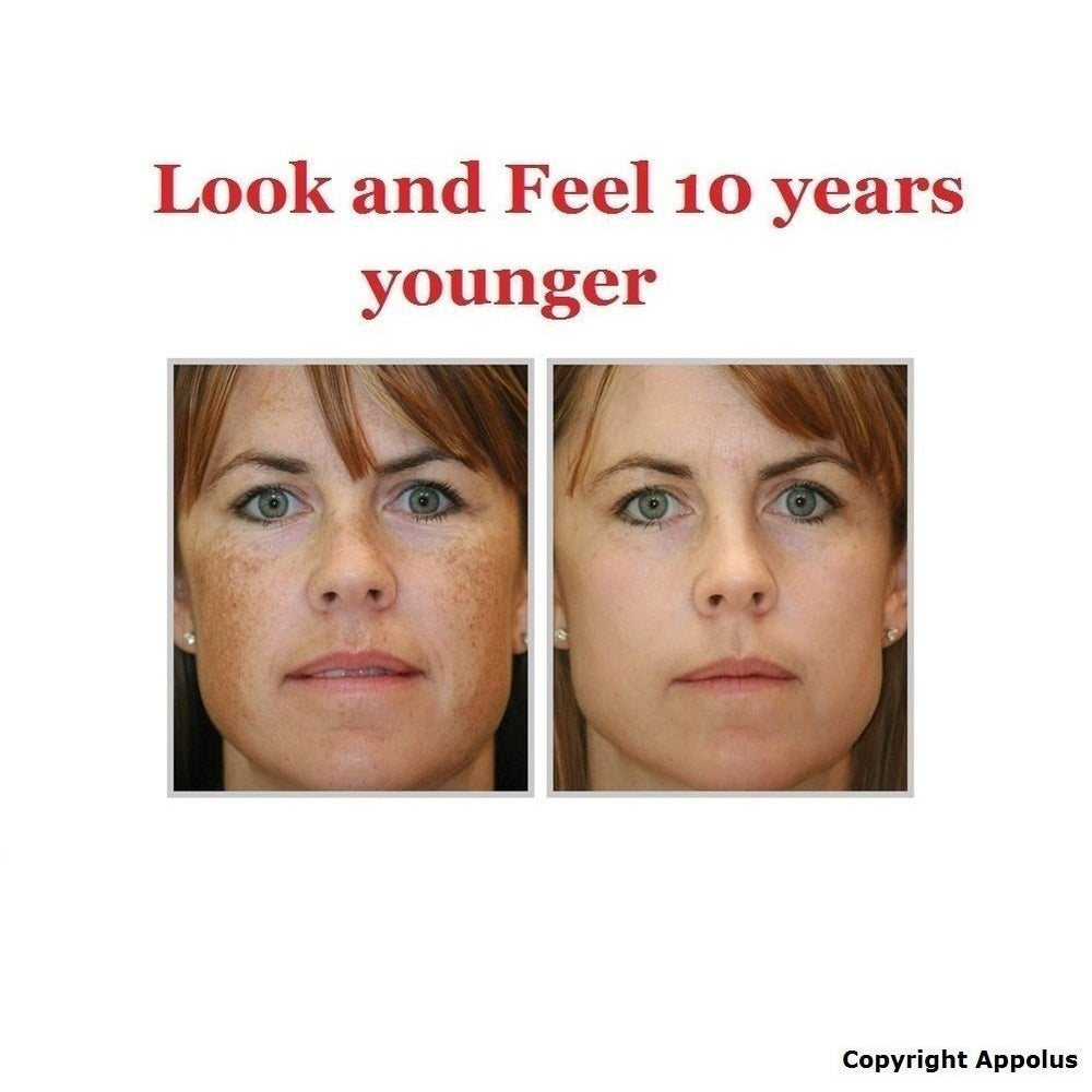 Appolus microdermabrasion kit prise en main rapide pour routine maison.