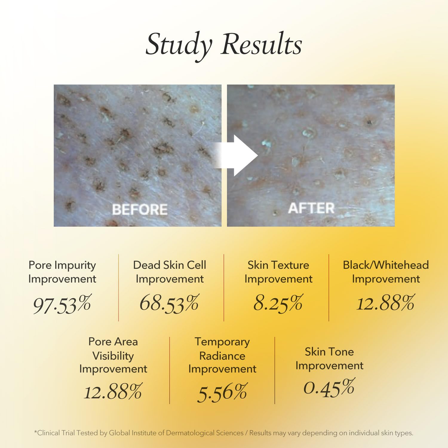 APRILSKIN masque-peel-off calendula : peau plus lisse et pores moins visibles