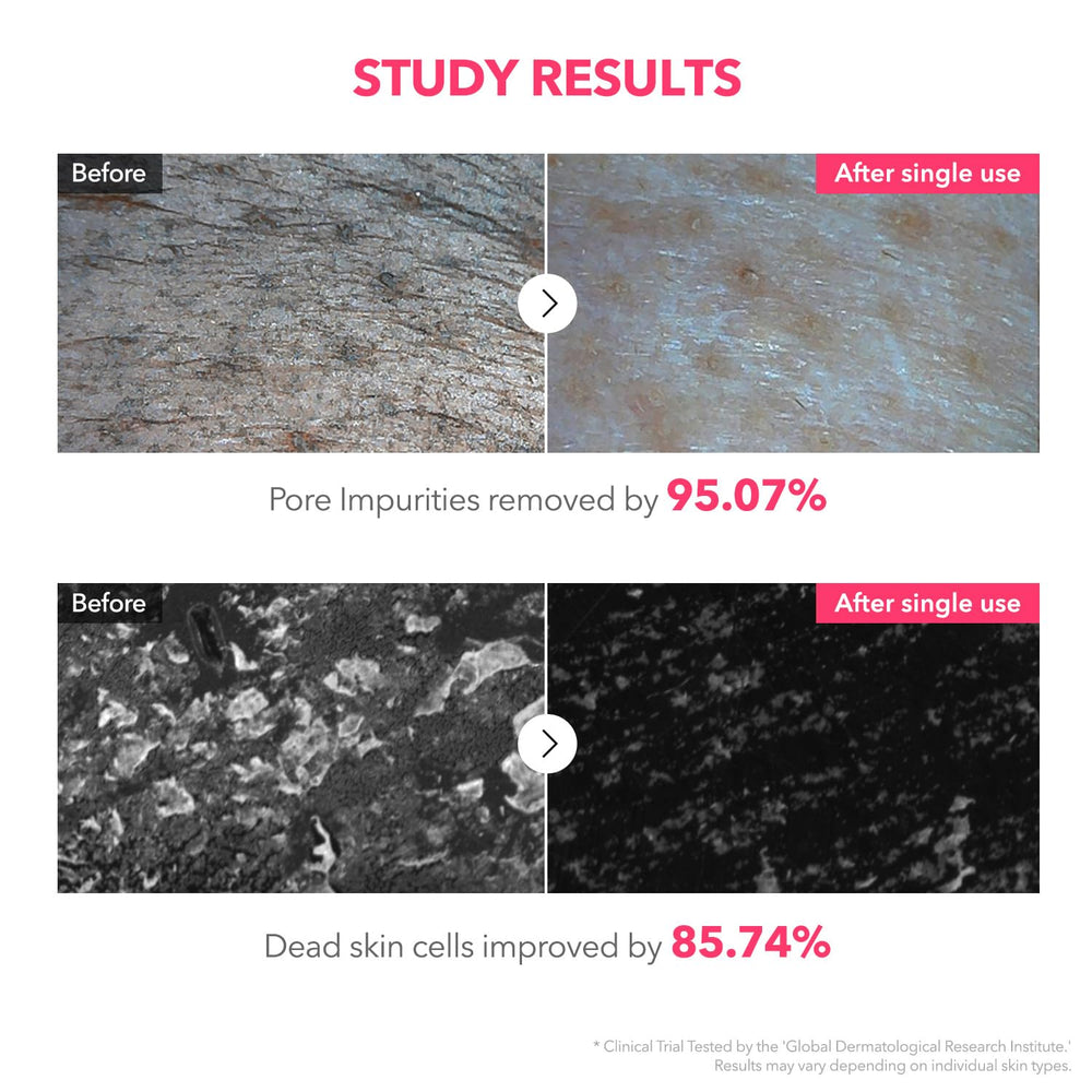 APRILSKIN TXA Niacinamide cleanser dual-action image suggests cleansing and pore refinement