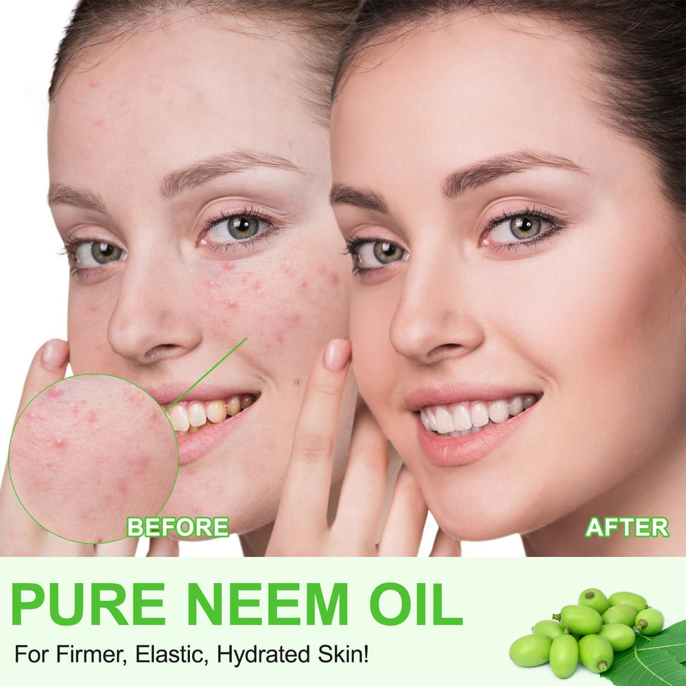 Huile neem sans hexane, pure et sûre.