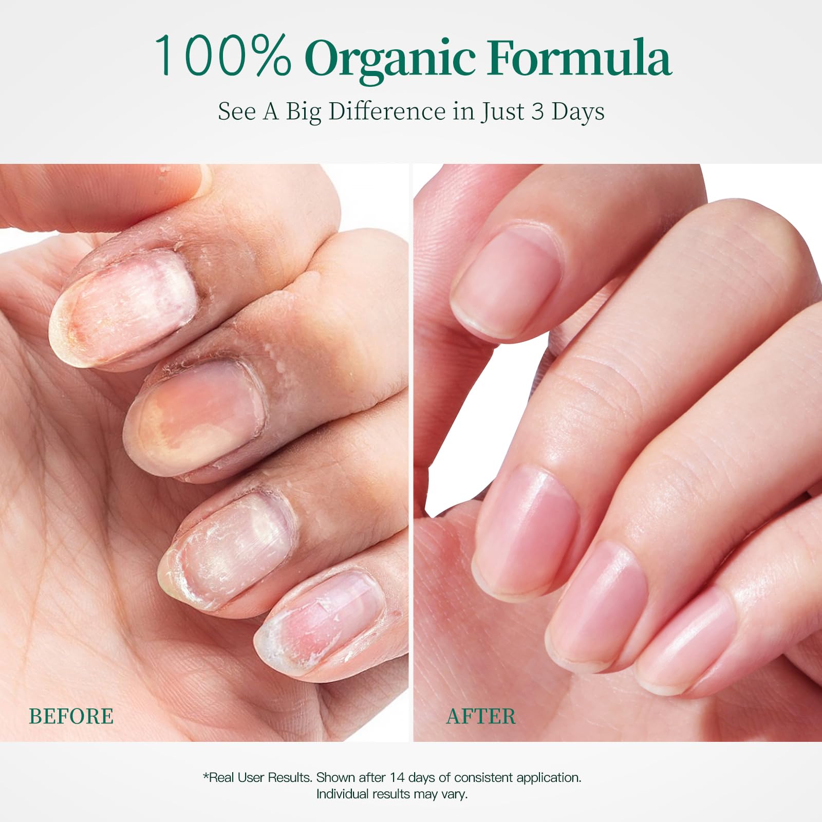 APUREE huile cuticules - applicateur: application précise sans résidu gras.