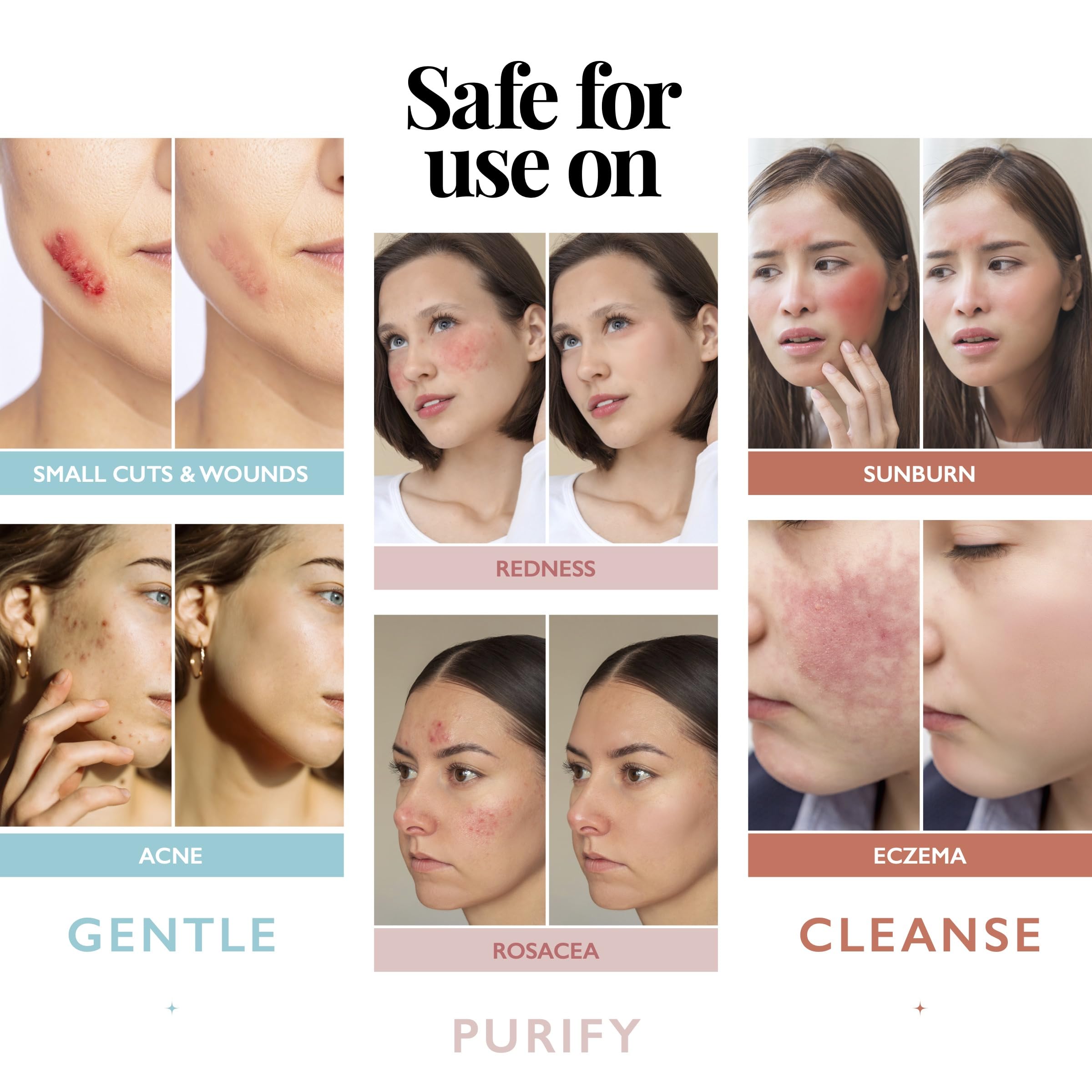 Application Aquia Hypochloreux Spray visage sur peau propre pour un soin léger.