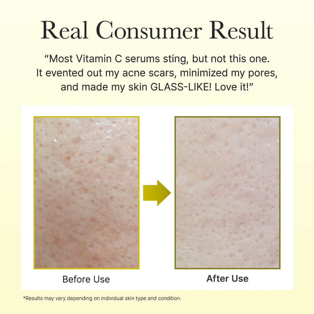 Arencia Vitamine C : peau plus lumineuse après application