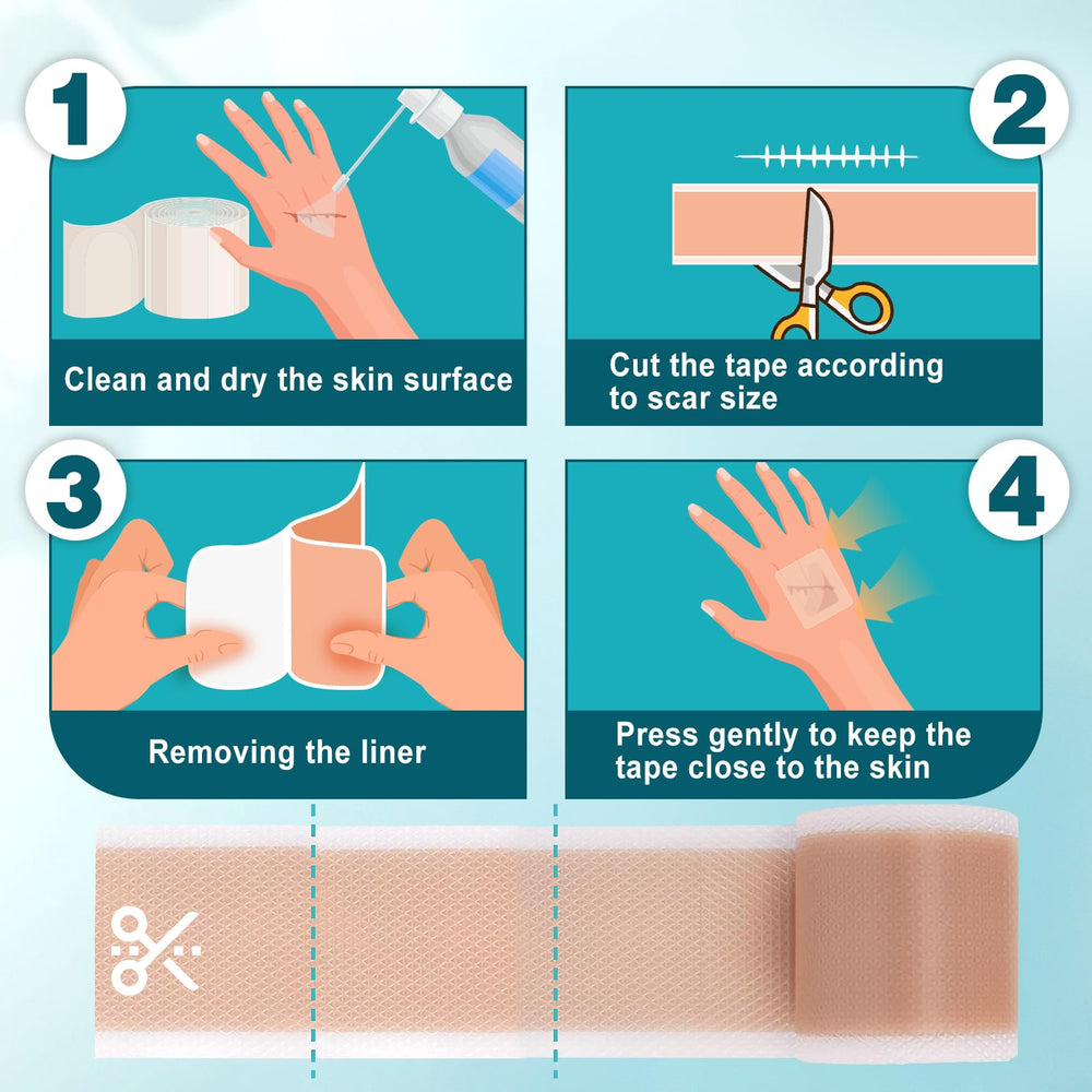 Barrière protectrice Arme pour réduire frottement et UV sur cicatrices.