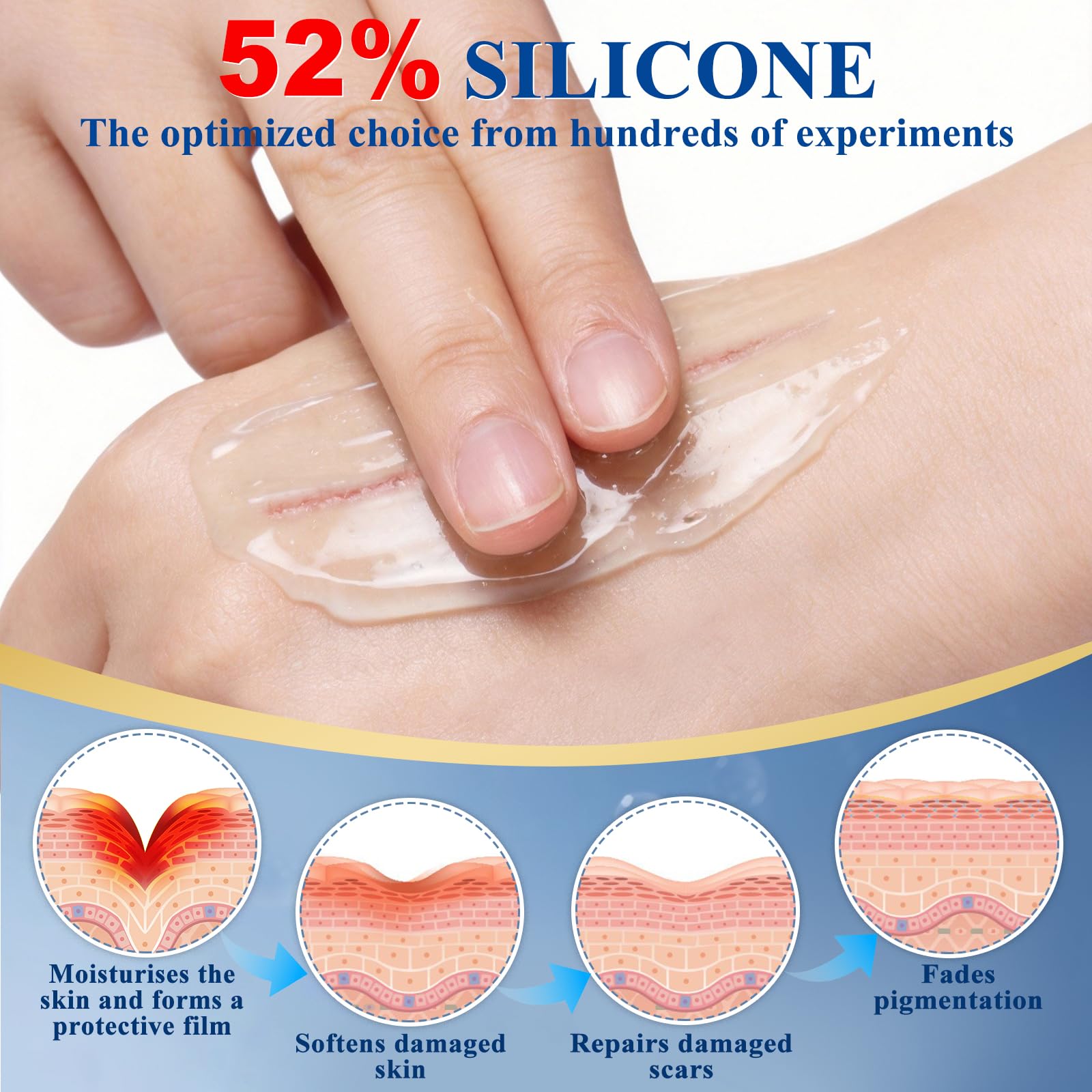 Arme Gel Silicone vergetures, peut contribuer a uniformiser le grain