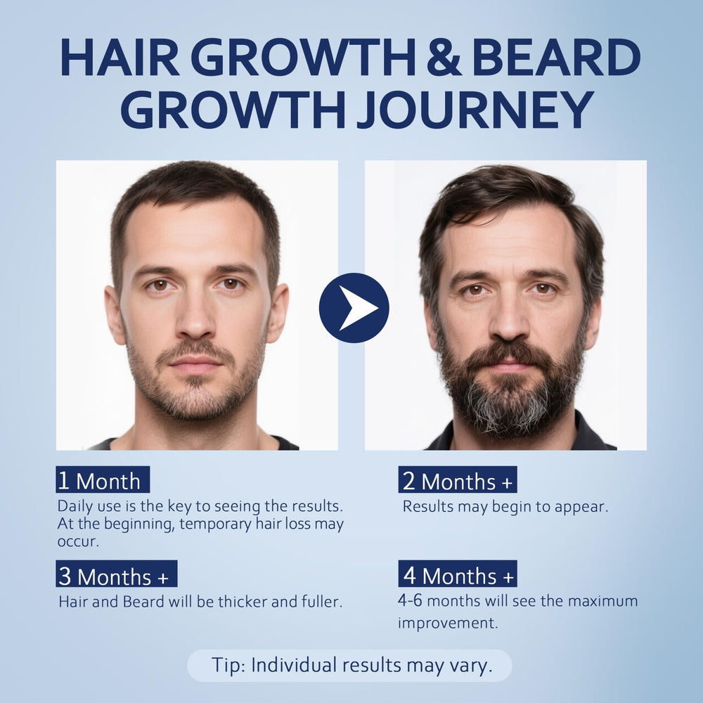 Artimore Minoxidil avec biotine pour soutenir les cheveux.