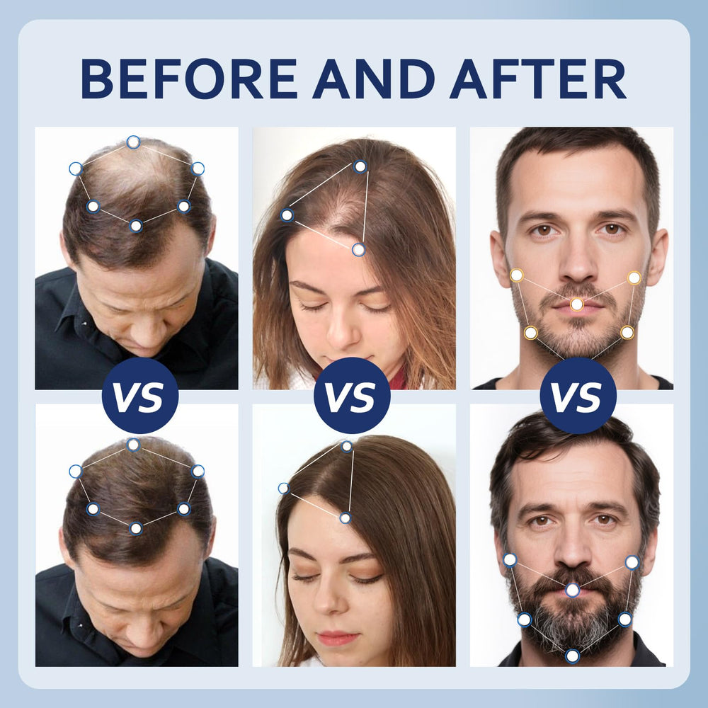 Artimore Minoxidil cheveux visiblement plus denses après utilisation.