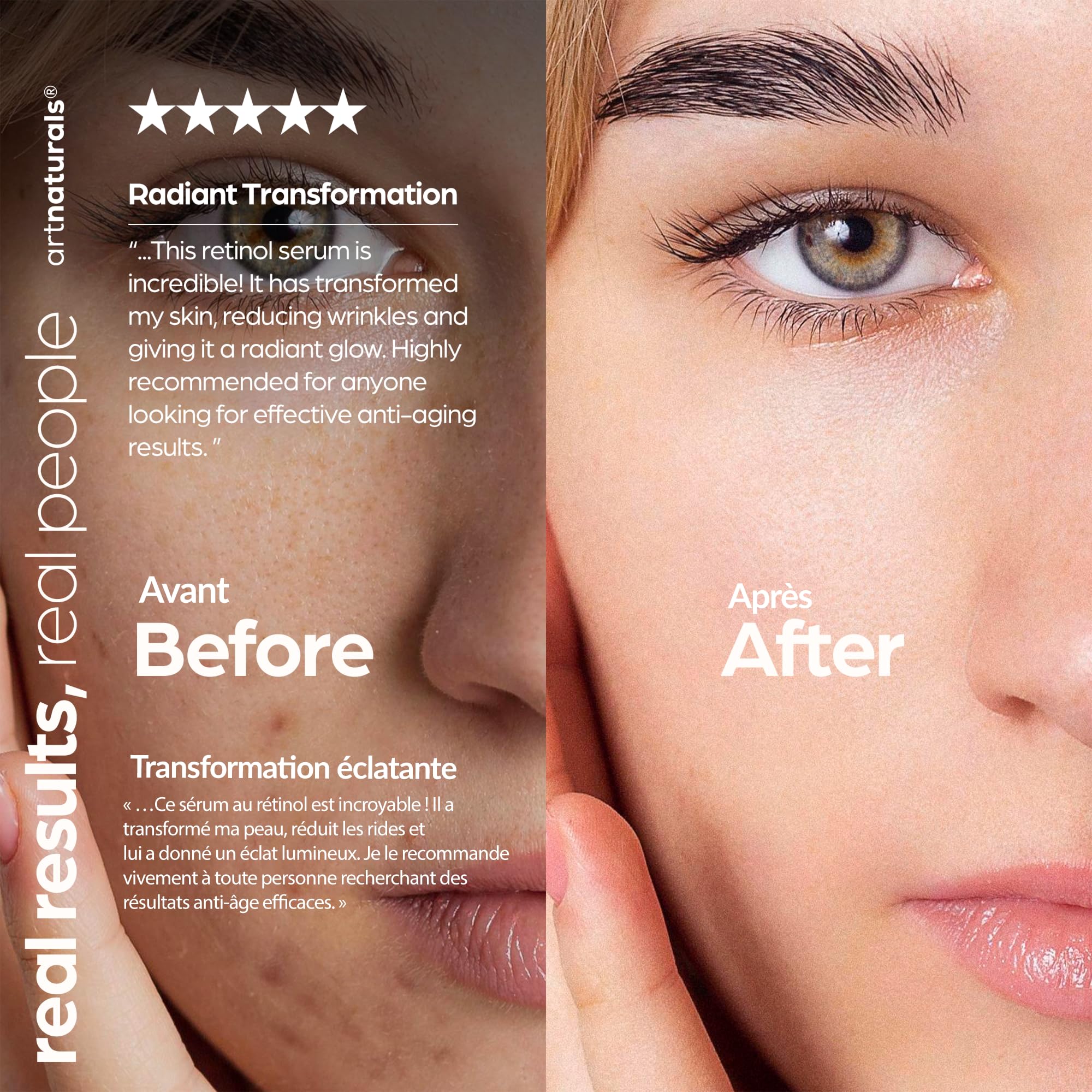 Artnaturals sérum retinol nuit – thérapie nocturne pour peau reposée.