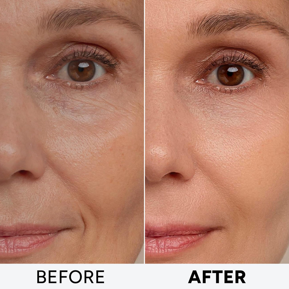 Arvesa raffermissement peau et élasticité avec actifs anti-âge.