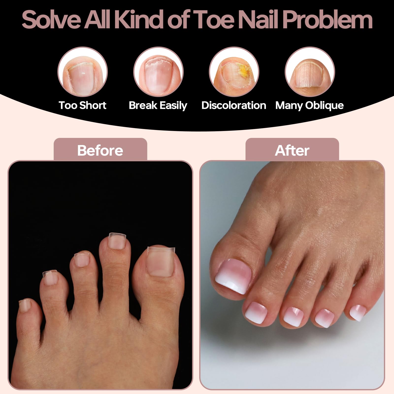ASONRL tips d’orteils : application rapide et confort lors de la pose.