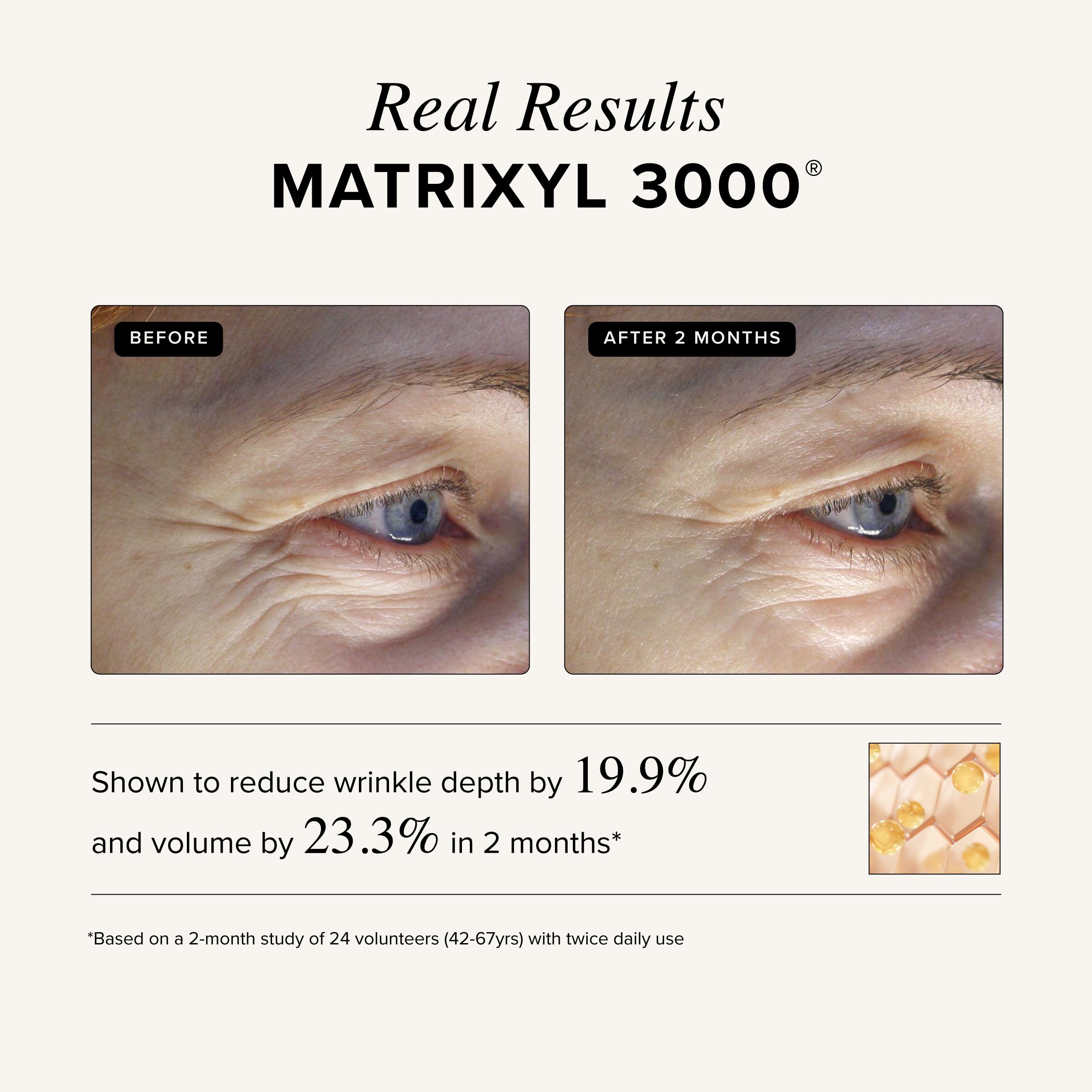 Asterwood Vitamin C Hyaluronic acid cream application showing hydration.