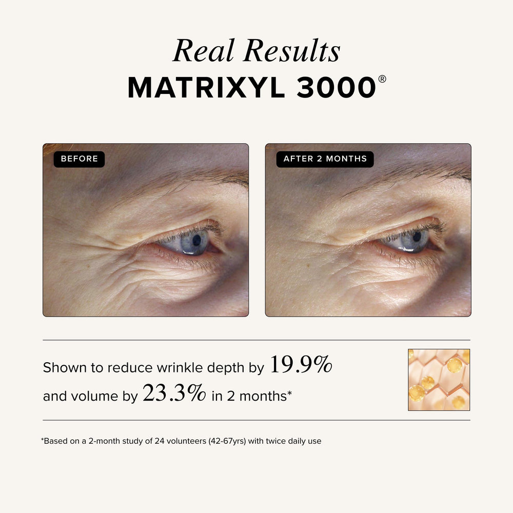 Asterwood Vitamin C Hyaluronic acid cream application showing hydration.