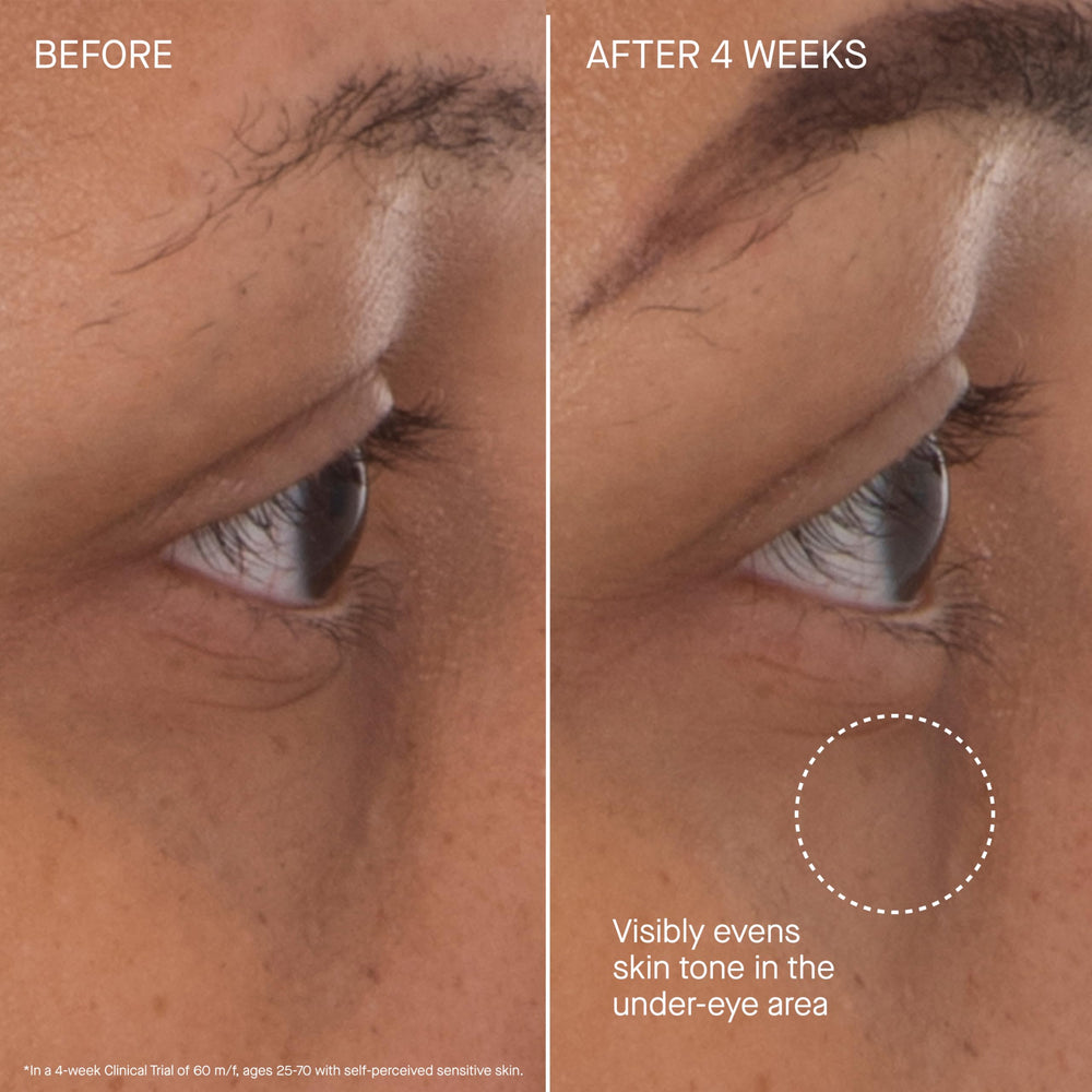 Patchs yeux Augustinus Bader, réduction visuelle des poches sous les yeux
