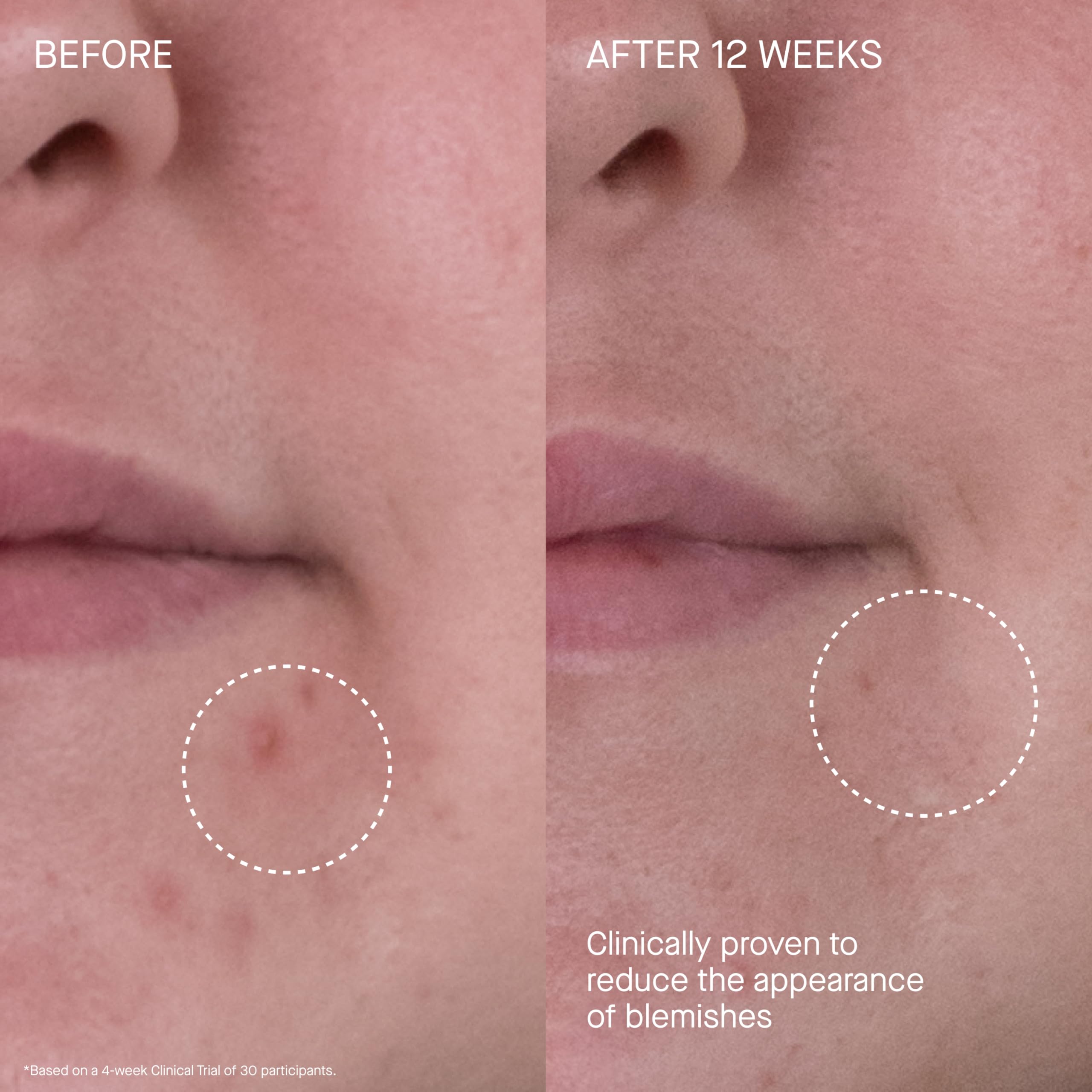 Application soir sur le décolleté pour nourrir en profondeur.