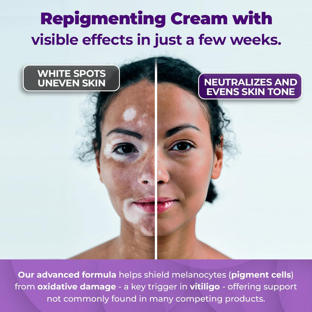 Crème Aura Vitamins sans parabènes adaptée aux peaux sensibles.