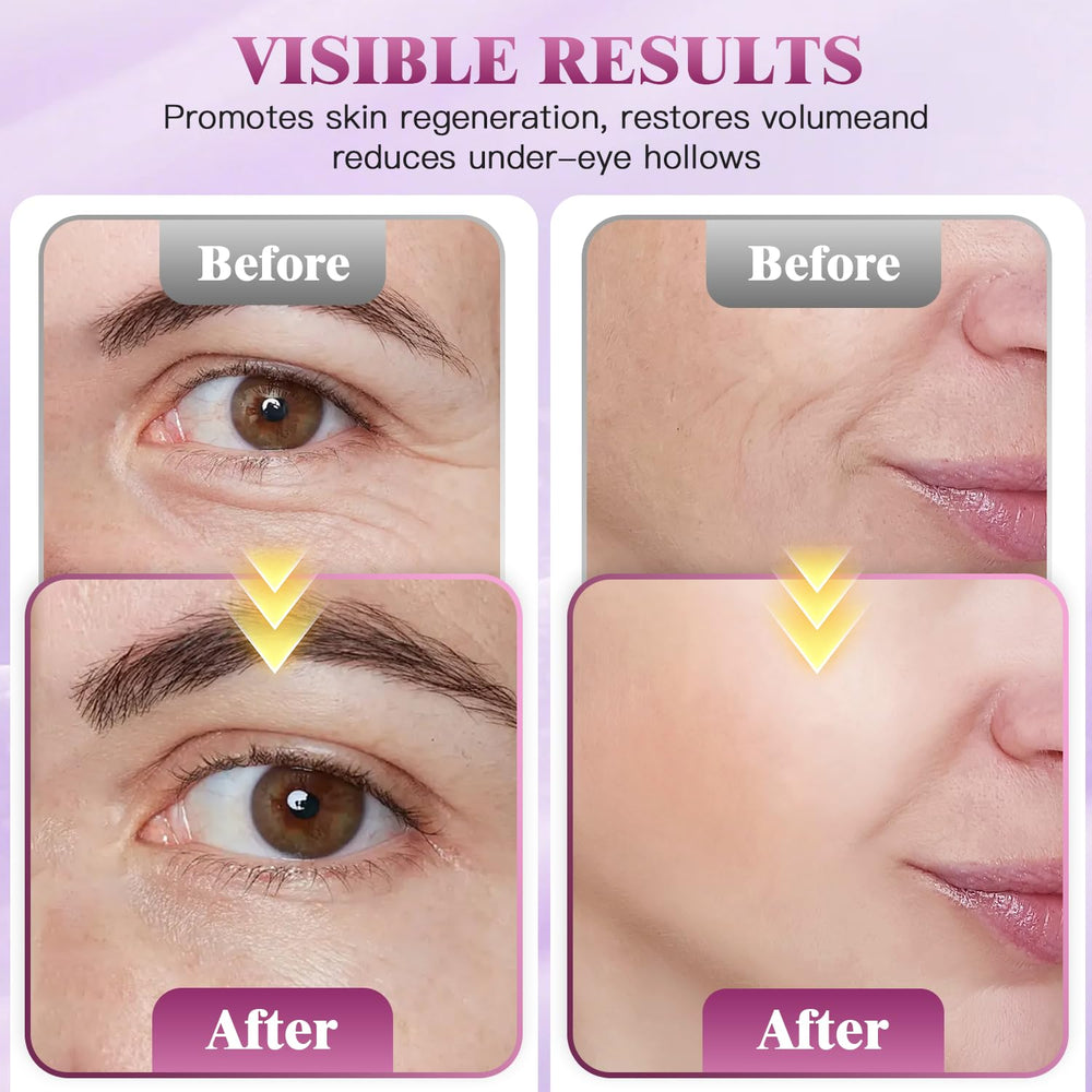 Auriela Calcium Volume Balm Stick – emballage compact et pratique pour voyage
