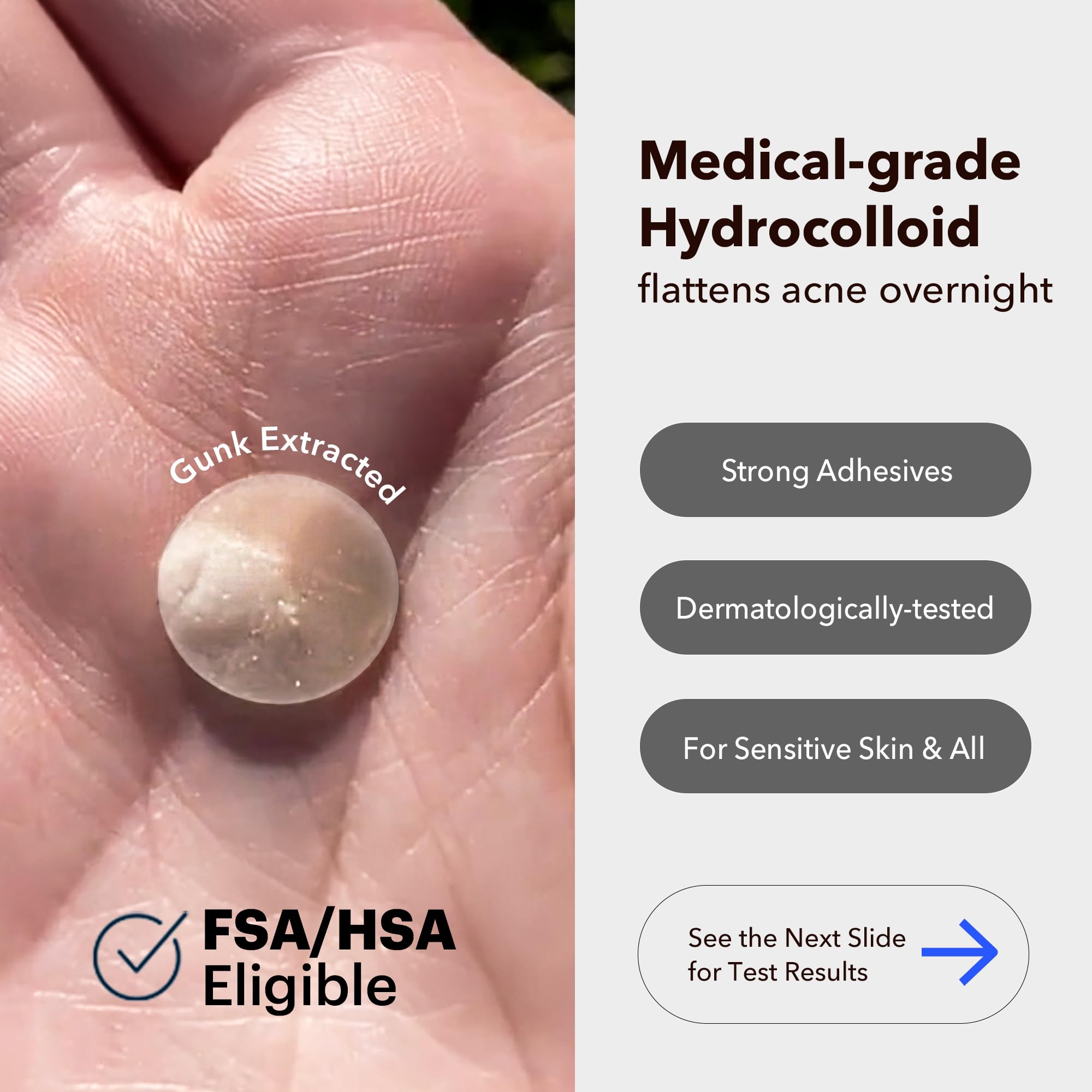 Pansement Avarelle bouton, hydrocolloïde absorbant pour réduire l apparence.