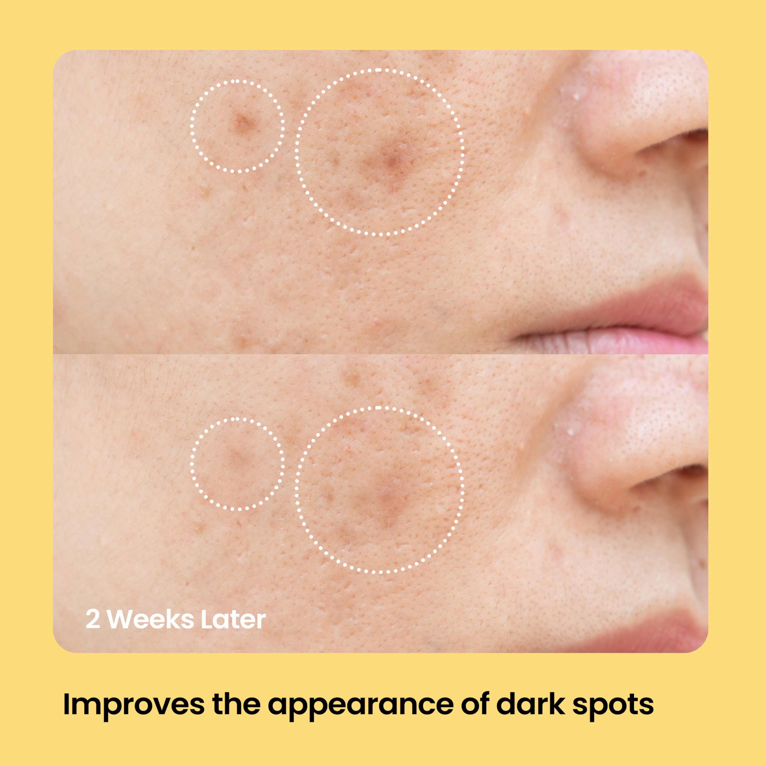 AVARELLE patch taches sur le visage en action, ciblant les zones concernées.