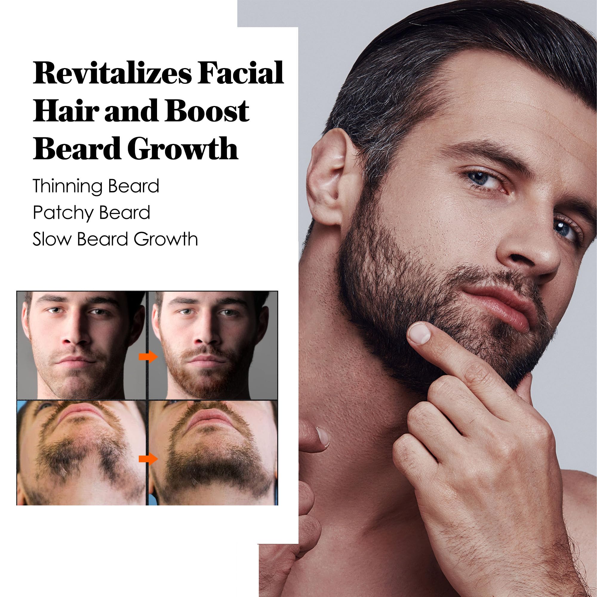 AVITAPURE huile minoxidil barbe composition biotine — nutriments essentiels pour la barbe