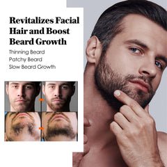 AVITAPURE huile minoxidil barbe composition biotine — nutriments essentiels pour la barbe