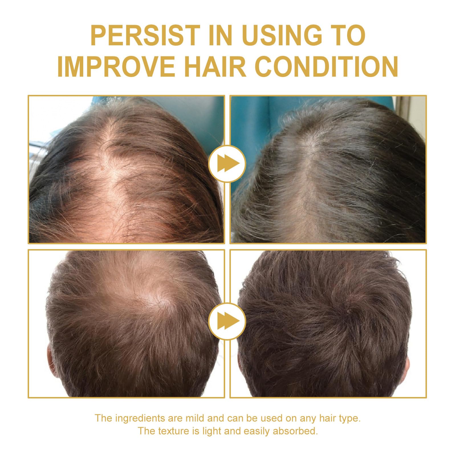 Axnzp formule naturelle avec plus de 10 huiles pour nourrir les cheveux.