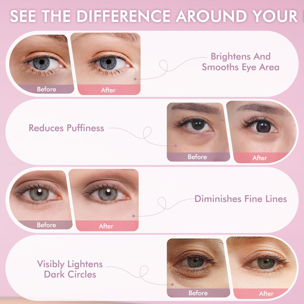 AzLucaky patchs yeux rose hydrogel hyaluronique pour hydratation ciblée