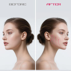Azrra Utilisation à domicile ou au bureau pour tonification du visage.