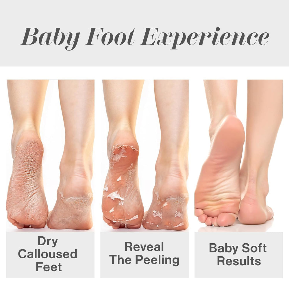 Baby Foot Lot Original – résultats durables pour pieds soignés