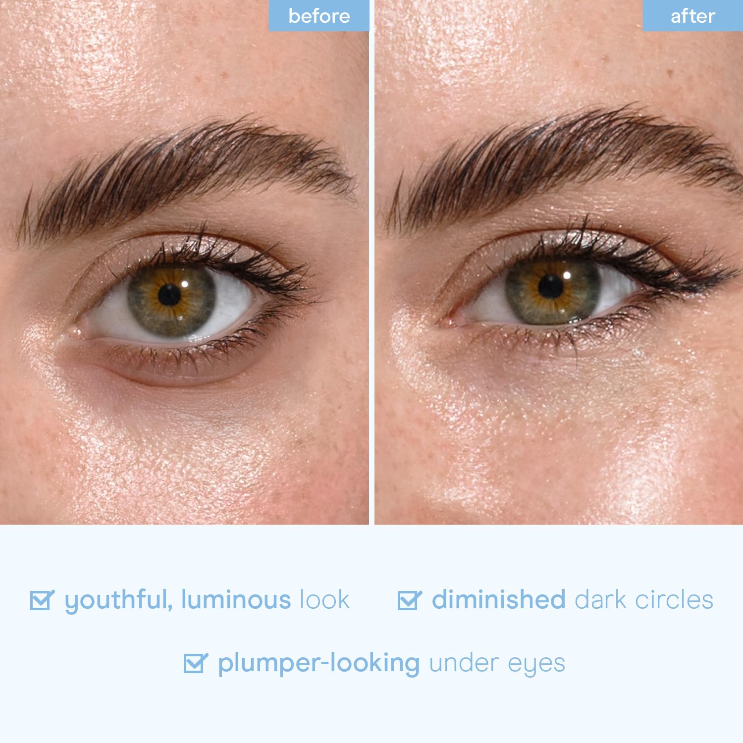 Baebody patchs yeux anti-rides – lissage potentiel des ridules