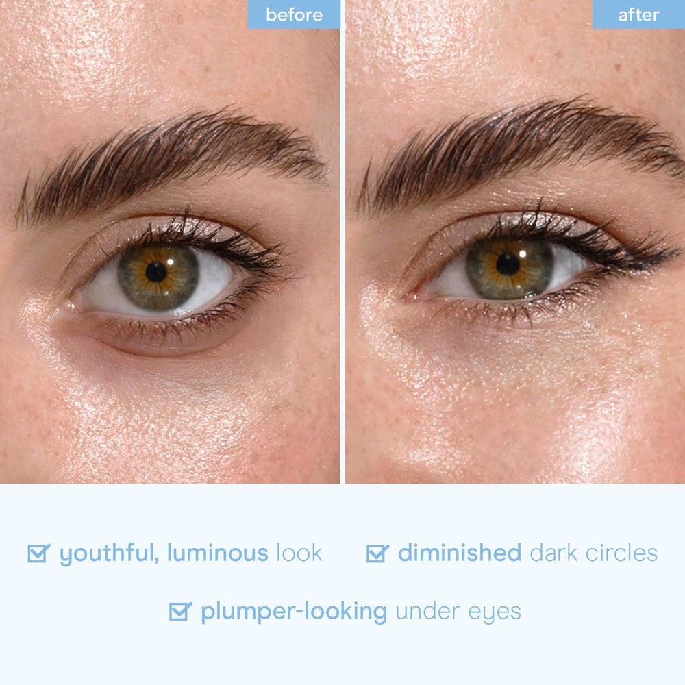 Baebody patchs yeux anti-rides – lissage potentiel des ridules