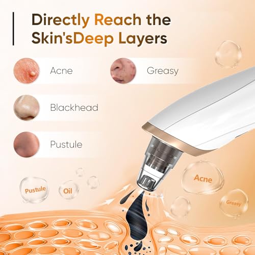 BAIIKO aspirateur visage trois niveaux d aspiration pour tous types de peau.