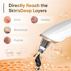 BAIIKO aspirateur visage trois niveaux d aspiration pour tous types de peau.