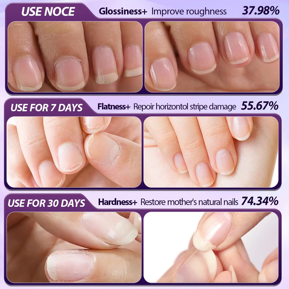 Baikupo arôme floral, expérience apaisante lors du soin des ongles.