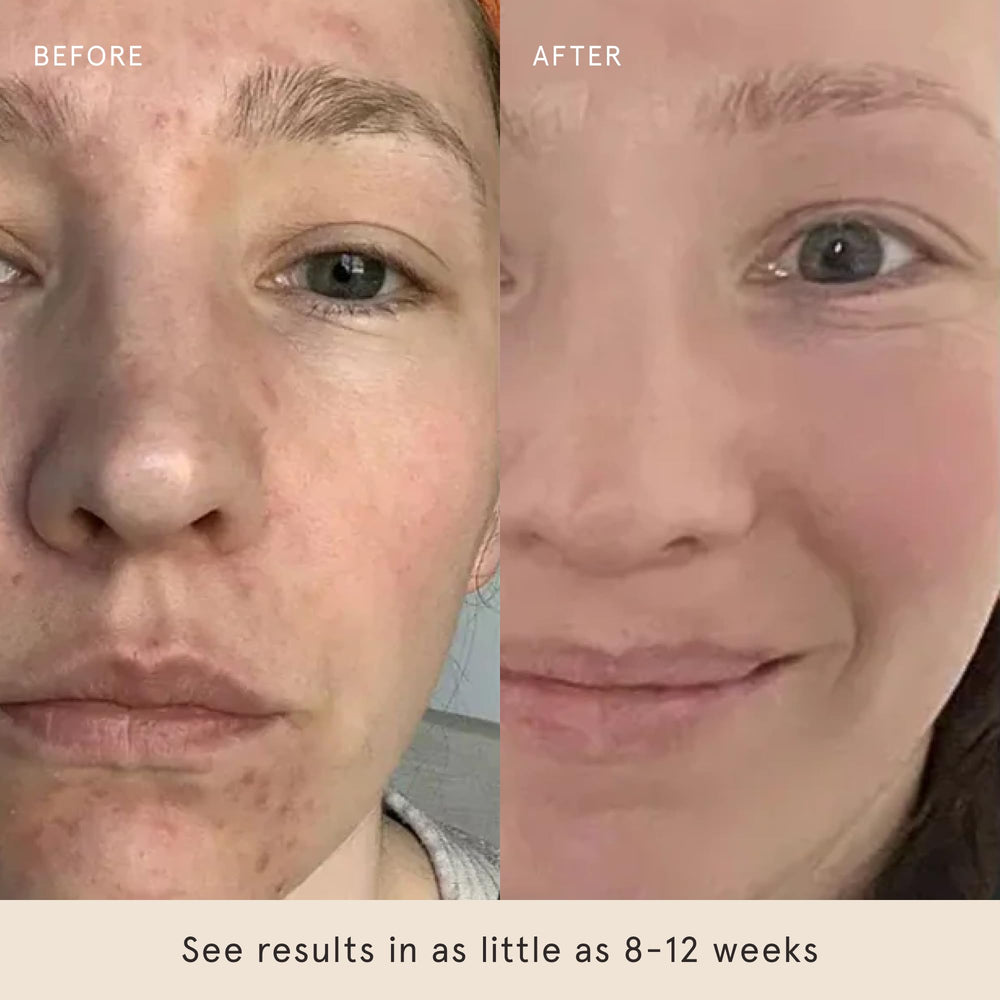 Barefaced Glow Peel Pads, menthol procurant une sensation fraîche et apaisante.