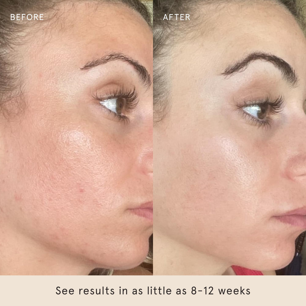 Barefaced Liquid Gold – peau lumineuse après utilisation régulière.