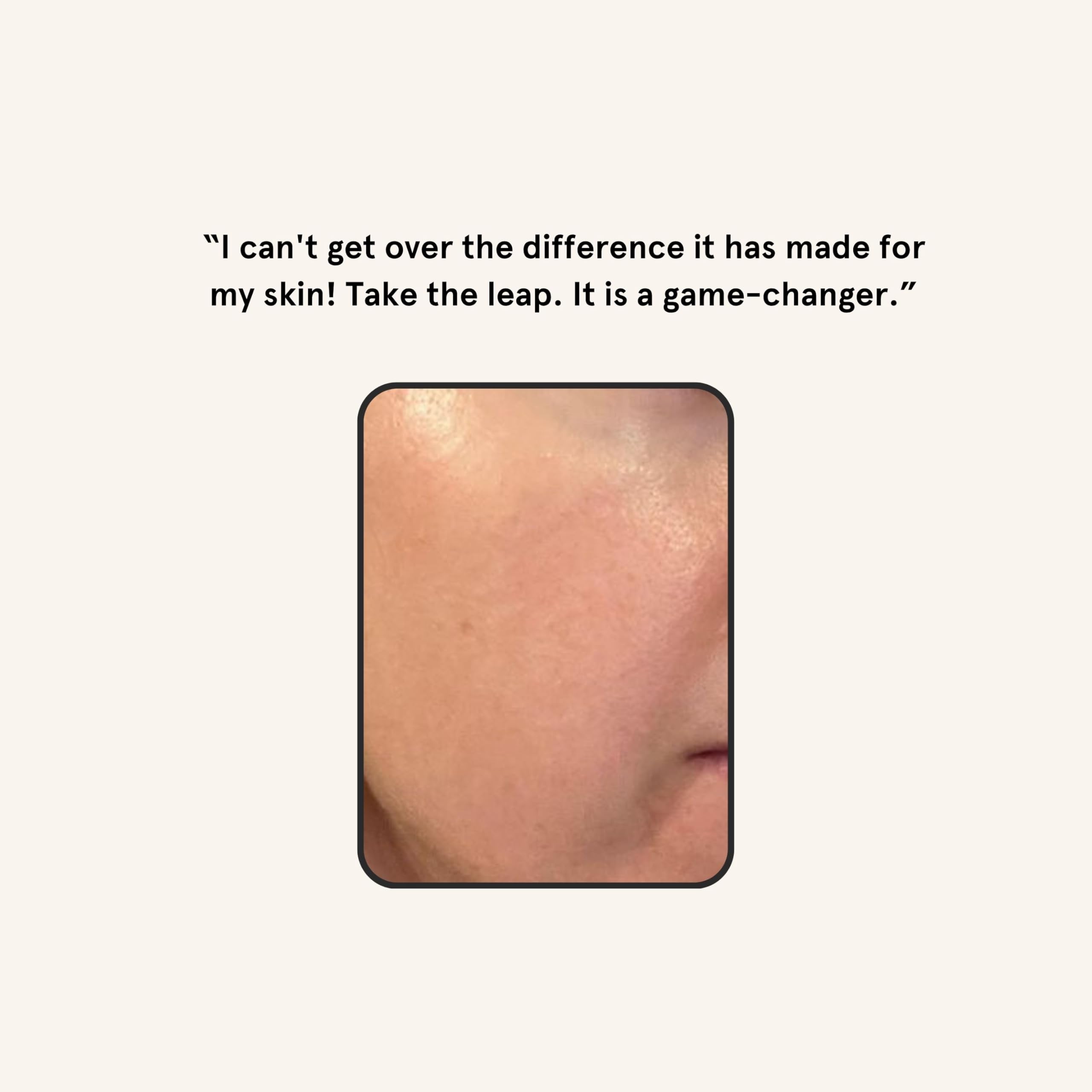 Avant et après dermaplaning avec Barefaced, peau plus lumineuse.