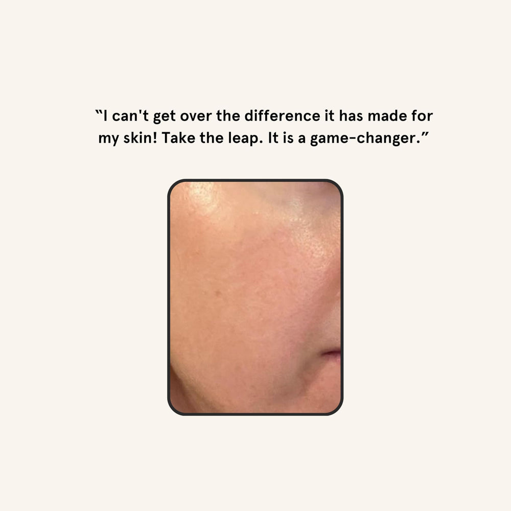 Avant et après dermaplaning avec Barefaced, peau plus lumineuse.