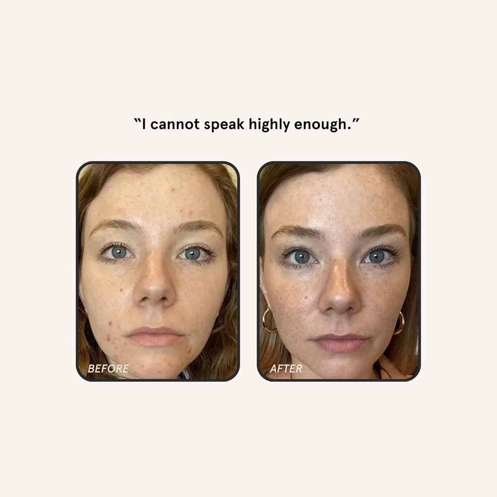 Peau plus lumineuse et tonifiée après utilisation régulière.