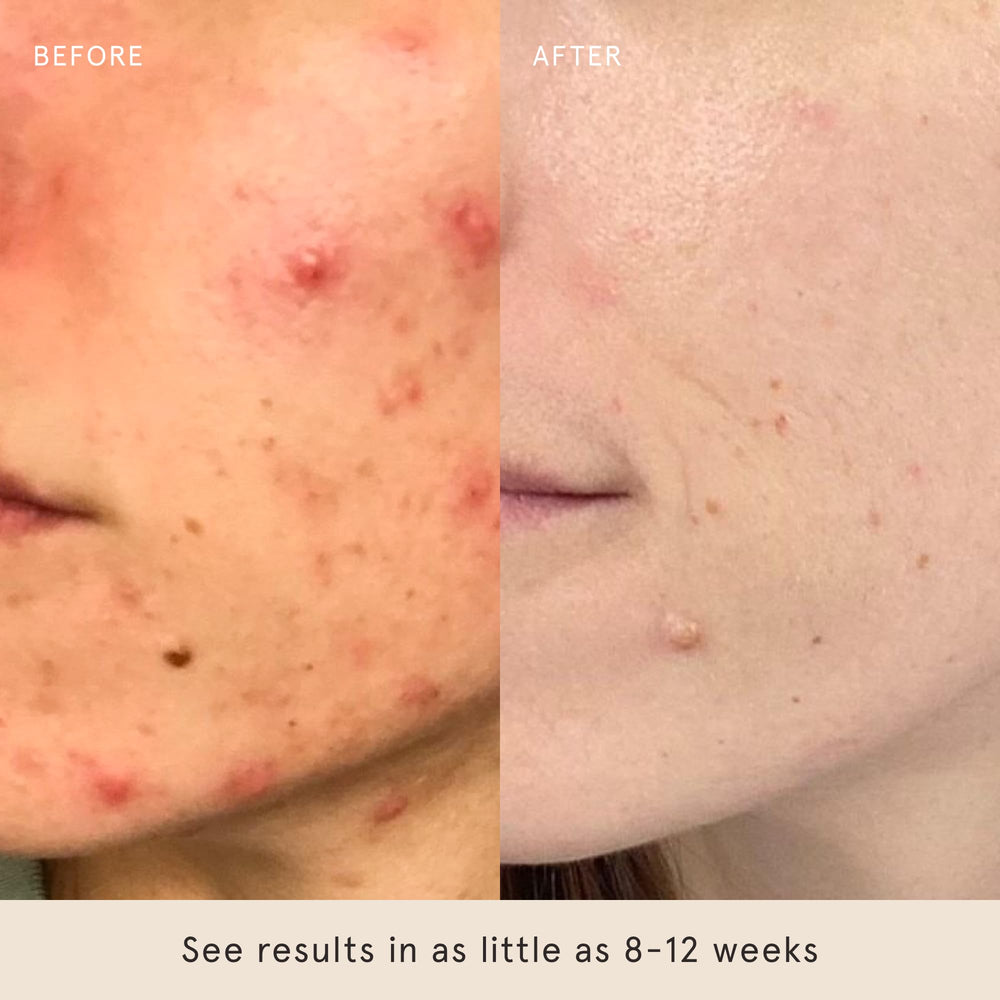 Gros plan sur l’action exfoliante et la douceur du soin.