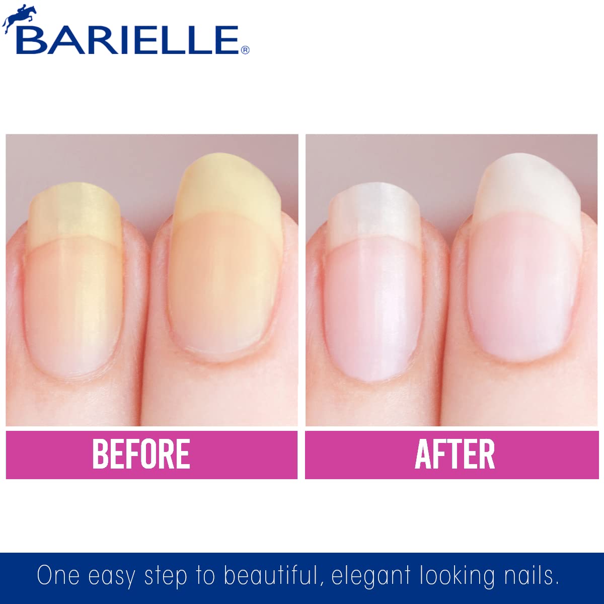 Barielle Nail Whitener – avant-après; ongles visiblement plus lumineux.