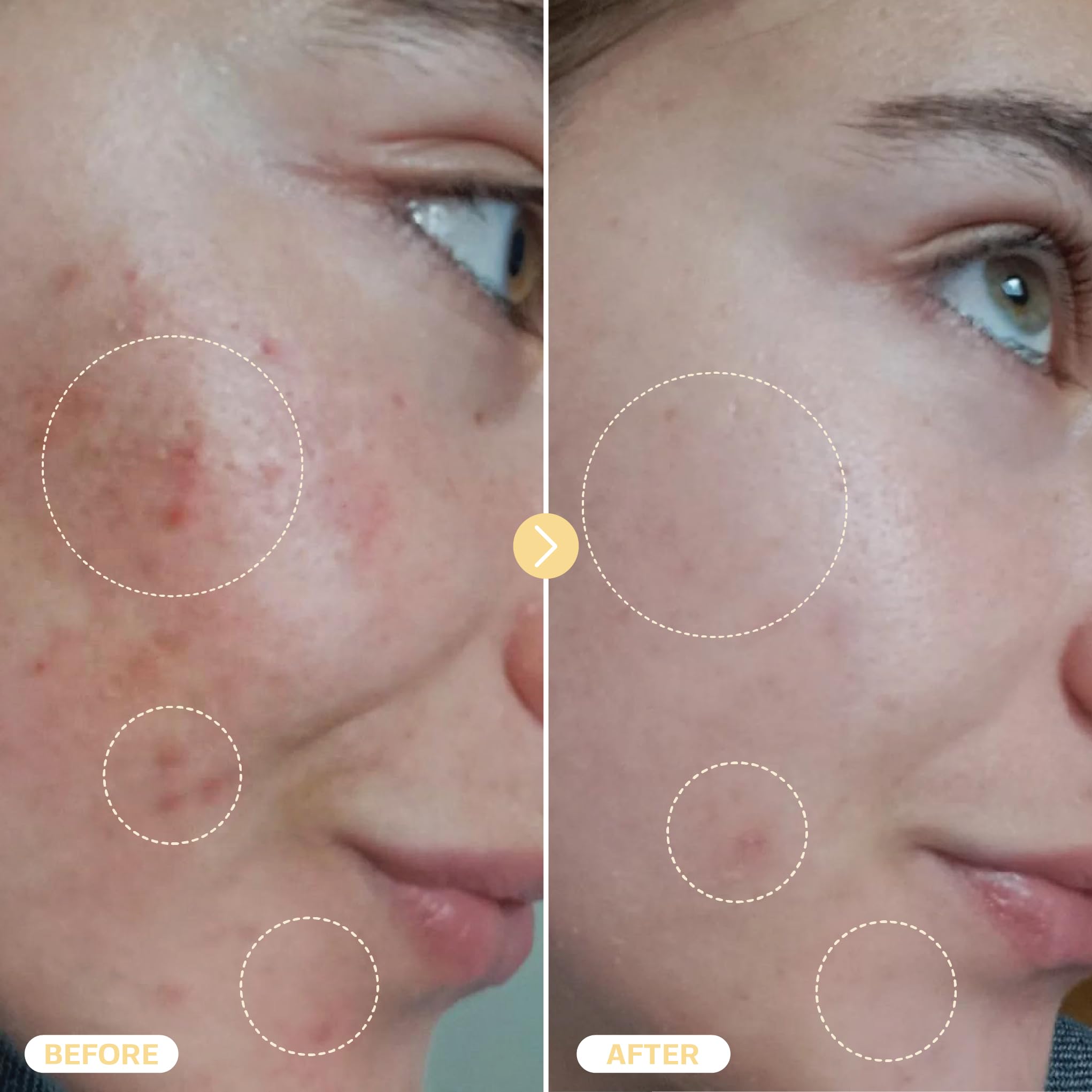 BASE LABORATORIES Hypochloreux spray eczéma – solution naturelle pour relief cutané.
