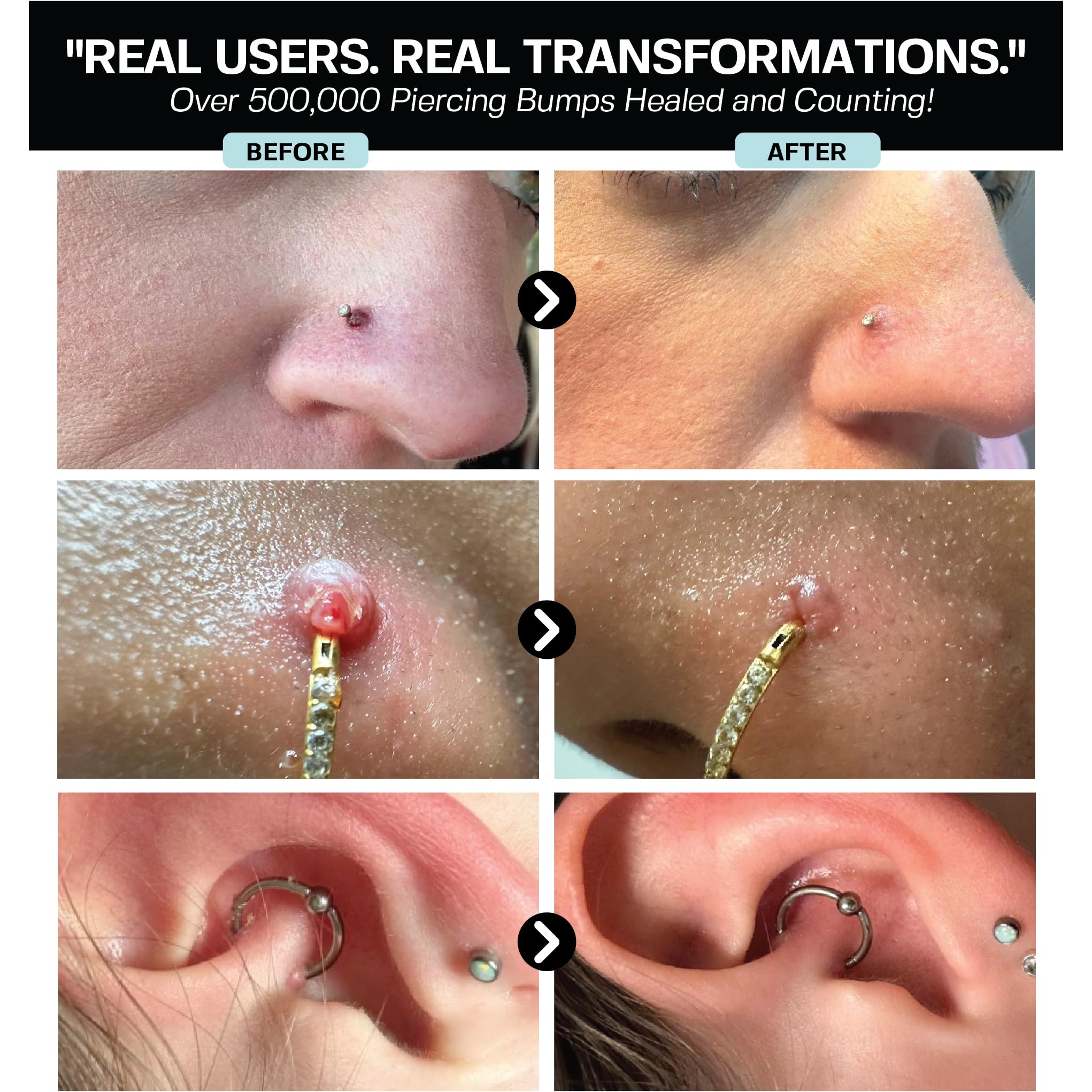 BASE LABORATORIES spray après-piercing, aide à réduire les irritations mineures.